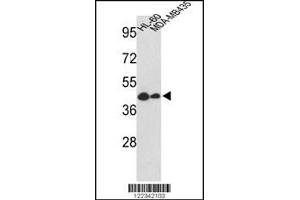 Western blot analysis of GSDMB Antibody in HL-60, MDA-MB435 cell line lysates (35ug/lane) (Gasdermin B 抗体  (AA 208-237))