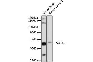 Western blot analysis of extracts of various cell lines, using  antibody (ABIN7265502) at 1:1000 dilution. (ADRB1 抗体  (AA 150-250))
