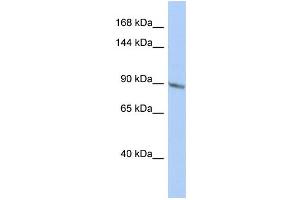 Host:  Rabbit  Target Name:  TBC1D2B  Sample Type:  HepG2 Whole cell lysates  Antibody Dilution:  1. (TBC1D2B 抗体  (Middle Region))