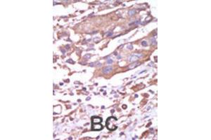 Immunohistochemistry (IHC) image for anti-Calcium/calmodulin-Dependent Protein Kinase II alpha (CAMK2A) antibody (ABIN3003046) (CAMK2A 抗体)