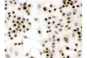 IHC analysis of p95 NBS1 using anti-p95 NBS1 antibody . (Nibrin 抗体  (C-Term))