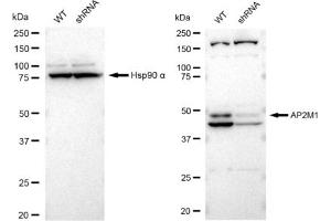 Western blotting analysis using AP2M1 antibody (ABIN7797509).