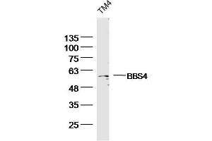 TM4 Mouse Cell lysates probed with BBS4 Polyclonal Antibody, unconjugated  at 1:300 overnight at 4°C followed by a conjugated secondary antibody for 60 minutes at 37°C. (BBS4 抗体  (AA 431-519))