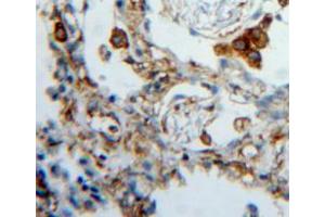 Used in DAB staining on fromalin fixed paraffin-embedded lung tissue (FKBP7 抗体  (AA 20-213))