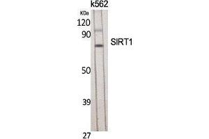 Western Blotting (WB) image for anti-Sirtuin 1 (SIRT1) (Tyr631) antibody (ABIN3177418) (SIRT1 抗体  (Tyr631))