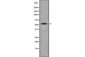 Western blot analysis of CYP3A5 using HepG2 whole cell lysates (CYP3A5 抗体)