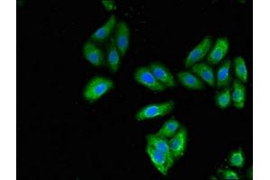Immunofluorescent analysis of HepG2 cells using ABIN7157444 at dilution of 1:100 and Alexa Fluor 488-congugated AffiniPure Goat Anti-Rabbit IgG(H+L) (Cytokeratin 7 抗体  (AA 2-469))