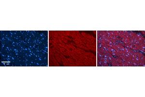 Rabbit Anti-SLC25A12 Antibody    Formalin Fixed Paraffin Embedded Tissue: Human Adult heart  Observed Staining: Cytoplasmic Primary Antibody Concentration: 1:100 Secondary Antibody: Donkey anti-Rabbit-Cy2/3 Secondary Antibody Concentration: 1:200 Magnification: 20X Exposure Time: 0. (SLC25A12 抗体  (Middle Region))