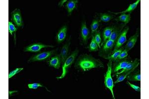 Immunofluorescent analysis of Hela cells using ABIN7158316 at dilution of 1:100 and Alexa Fluor 488-congugated AffiniPure Goat Anti-Rabbit IgG(H+L) (LHFPL1 抗体  (AA 21-85))