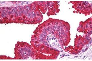 Anti-ABCA5 antibody IHC staining of human prostate. (ABCA5 抗体)