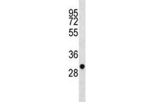 Western Blotting (WB) image for anti-Succinate Dehydrogenase Complex, Subunit B, Iron Sulfur (Ip) (SDHB) (AA 205-234) antibody (ABIN3032762)