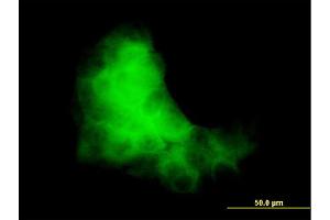 Immunofluorescence of monoclonal antibody to S100A7 on A-431 cell. (S100A7 抗体  (AA 1-101))