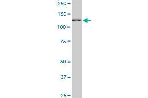 CAND1 monoclonal antibody (M03), clone 2D7. (CAND1 抗体  (AA 1-100))