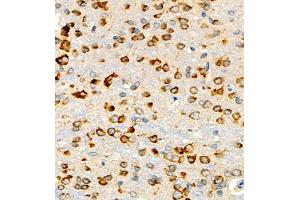 Immunohistochemistry of paraffin embedded mouse brain using P4H (ABIN7074215) at dilution of 1:700 (400x lens) (HIF Prolyl Hydroxylase 抗体)