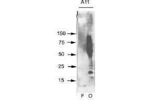 Aβ42 fibrils (F) and prefibrillar oligomers (O) were run on SDS polyacrylamide gels, transferred to nitrocellulose and probed with this antibody (A11). (Amyloid Oligomers 抗体)