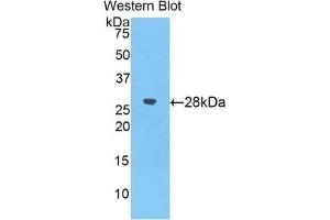 WB of Protein Standard: different control antibodies against Highly purified E. (alpha 2 Macroglobulin ELISA 试剂盒)