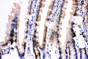 Anti- Ubiquitin Picoband antibody, IHC(P) IHC(P): Mouse Intestine Tissue (Ubiquitin B 抗体  (AA 77-152))