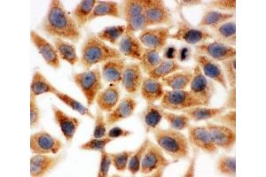Immunocytochemistry (ICC) image for anti-Hydroxysteroid (17-Beta) Dehydrogenase 1 (HSD17B1) (AA 29-43) antibody (ABIN3031269)