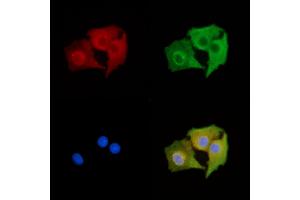ABIN7095207 and ABIN7099263 staining  cells by IF/ICC.