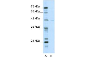 WB Suggested Anti-TRIM38 Antibody Titration:  5. (TRIM38 抗体  (N-Term))