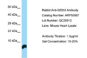 Western Blotting (WB) image for anti-General Transcription Factor IIH, Polypeptide 5 (GTF2H5) (N-Term) antibody (ABIN970845) (GTF2H5 抗体  (N-Term))