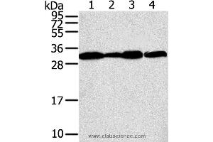 Western blot analysis of A375, A431, lovo and hela cell, using STX10 Polyclonal Antibody at dilution of 1:800 (Syntaxin 10 抗体)