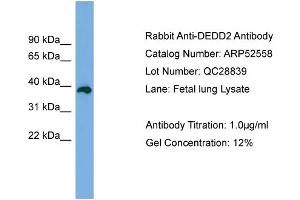 WB Suggested Anti-DEDD2  Antibody Titration: 0. (DEDD2 抗体  (Middle Region))