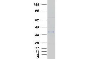 Western Blotting (WB) image for Cysteine-Rich with EGF-Like Domains 1 (CRELD1) (Transcript Variant 1) protein (Myc-DYKDDDDK Tag) (ABIN2712554)