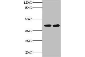 Western blot All lanes: GLT8D2 antibody at 2 μg/mL Lane 1: Mouse heart tissue Lane 2: Mouse kidney tissue Secondary Goat polyclonal to rabbit IgG at 1/10000 dilution Predicted band size: 41 kDa Observed band size: 41 kDa (GLT8D2 抗体  (AA 25-349))