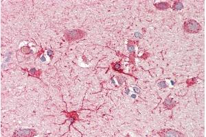 ABIN1590086 (5µg/ml) staining of paraffin embedded Human Cortex. (CROT 抗体  (AA 178-199))