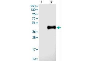 Western blot analysis of Lane 1: Negative control (vector only transfected HEK293T lysate), Lane 2: Over-expression Lysate (Co-expressed with a C-terminal myc-DDK tag (~3. (IL22RA2 抗体)