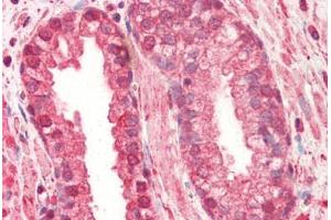 Human Prostate (formalin-fixed, paraffin-embedded) stained with CTSL1 antibody ABIN364356 at 5 ug/ml followed by biotinylated anti-mouse IgG secondary antibody ABIN481714, alkaline phosphatase-streptavidin and chromogen. (Cathepsin L 抗体  (AA 114-333))
