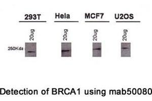 Image no. 4 for anti-Breast Cancer 1 (BRCA1) (AA 1314-1600), (AA 1314-1864) antibody (ABIN363234) (BRCA1 抗体  (AA 1314-1600, AA 1314-1864))