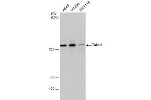 WB Image Talin 1 antibody detects Talin 1 protein by western blot analysis. (TLN1 抗体  (C-Term))