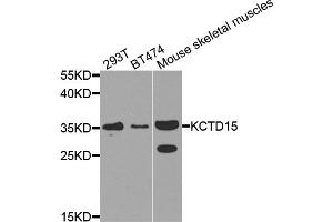 Western blot analysis of extracts of various cell lines, using KCTD15 antibody. (KCTD15 抗体)