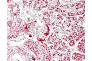 Immunohistochemistry (IHC) image for anti-ClpP Caseinolytic Peptidase, ATP-Dependent, Proteolytic Subunit Homolog (E. Coli) (CLPP) (AA 215-277) antibody (ABIN2619316)