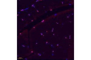 Immunofluorescence (Paraffin-embedded Sections) (IF (p)) image for anti-Tumor Necrosis Factor Receptor Superfamily, Member 17 (TNFRSF17) antibody (ABIN7076067)