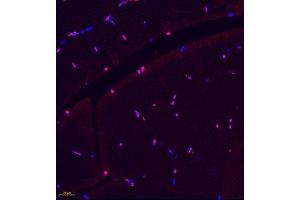 Immunofluorescence of paraffin embedded rat skeletal muscle using BCMA (ABIN7076067) at dilution of 1: 600 (400x lens) (BCMA 抗体)