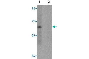 Western blot analysis of mouse lung tissue with ZSCAN4 polyclonal antibody  in (Lane 1) the absence and (Lane 2) presence of peptide blocking. (ZSCAN4 抗体  (C-Term))