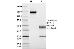 SDS-PAGE Analysis Purified HLA-DR Mouse Monoclonal Antibody (DA2). (HLA-DRB1 抗体)