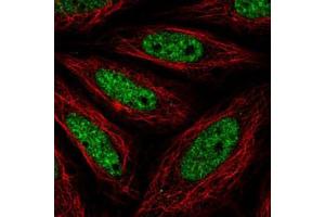 Immunofluorescent staining of SiHa cells with NR4A2 polyclonal antibody  (Green) shows positivity in nucleus but excluded from the nucleoli. (NR4A2 抗体)