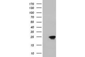HEK293T cells were transfected with the pCMV6-ENTRY control (Left lane) or pCMV6-ENTRY DUPD1 (Right lane) cDNA for 48 hrs and lysed. (DUPD1 抗体)