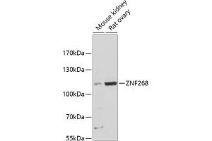 Western blot analysis of extracts of various cell lines, using ZNF268 antibody (ABIN6133062, ABIN6150485, ABIN6150486 and ABIN6216704) at 1:3000 dilution. (ZNF268 抗体  (AA 1-270))
