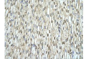 Rabbit Anti-C14ORF156 antibody   Paraffin Embedded Tissue: Human Heart cell Cellular Data: cardiac cell of renal tubule Antibody Concentration: 4.