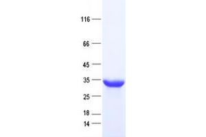 Western Blotting (WB) image for Cell Division Cycle Associated 4 (CDCA4) protein (His tag) (ABIN2713850)
