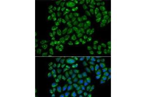 Immunofluorescence analysis of HeLa cells using GRIA3 Polyclonal Antibody (Glutamate Receptor 3 抗体)