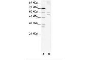 Image no. 1 for anti-Autoimmune Regulator (AIRE) (AA 76-125) antibody (ABIN203264) (AIRE 抗体  (AA 76-125))