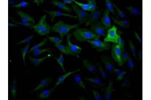 Immunofluorescence staining of Hela Cells with ABIN7127459 at 1:50, counter-stained with DAPI. (Recombinant DNM2 抗体)