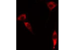 ABIN6274329 staining RAW264. (FOXC1 抗体)