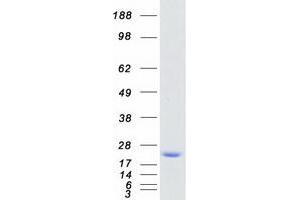 Myosin, Light Chain 2, Regulatory, Cardiac, Slow (MYL2) protein (Myc-DYKDDDDK Tag)